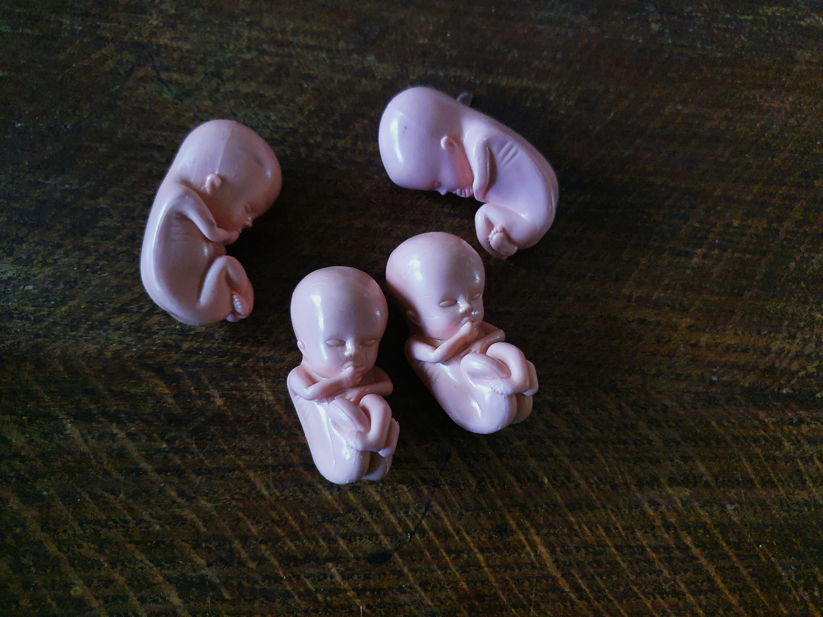 ngv foetus